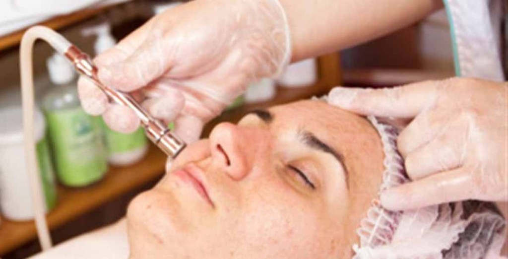 laser-treatment-for-acne-scars